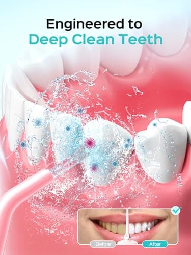 COSLUS Portable Water Flosser for Teeth: 10 Pressure Settings Professional Water Dental Pick for Orthodontic, Braces & Sensitive Gums - Cordless for Travel Use, for Adults Teens, BPA-Free, E40