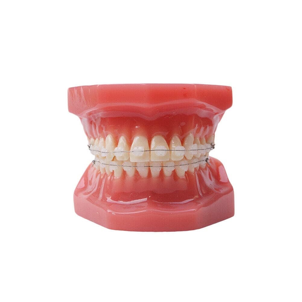 Dental Typodont With Ceramic Brackets Orthodontic Braces Teeth Model,28pcs Teeth Ceramic Braces Model For Teaching Practice