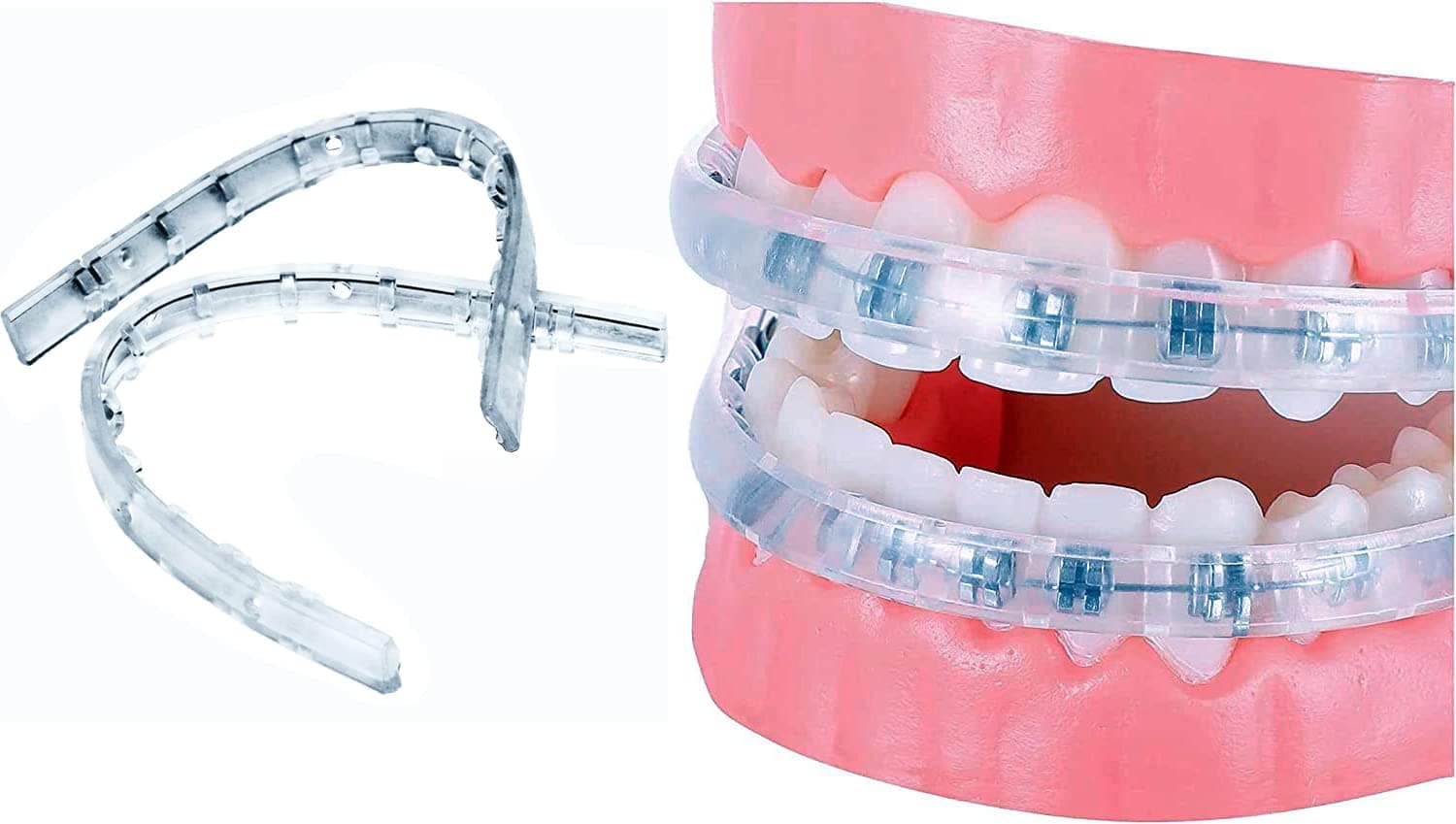 Comfort Cover for Braces, Lip Protector Mouth Guard Lip Cushion Teeth Shield Bumper for Brackets, Aligner, Dental Wax Alternative, Hard and Rigid Clip