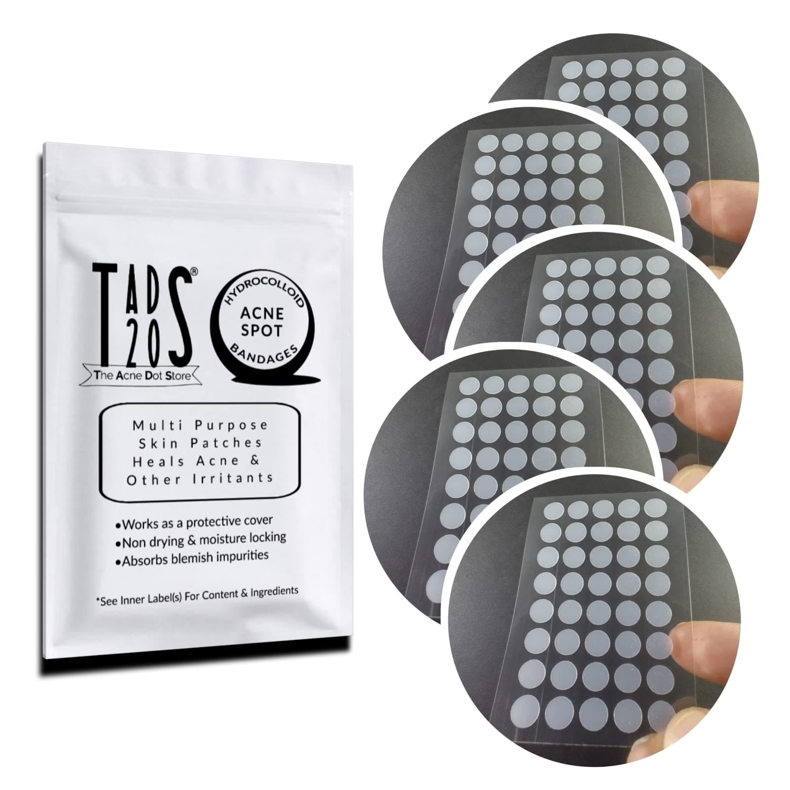 5pk, [200] Acne Dot Pimple Patches [SMALL SIZE] Cystic Acne Patch, FACE Spot Dots, Zit Sticker, Hydrocolloid Bandages, Blemish Spot Treatment, tads20