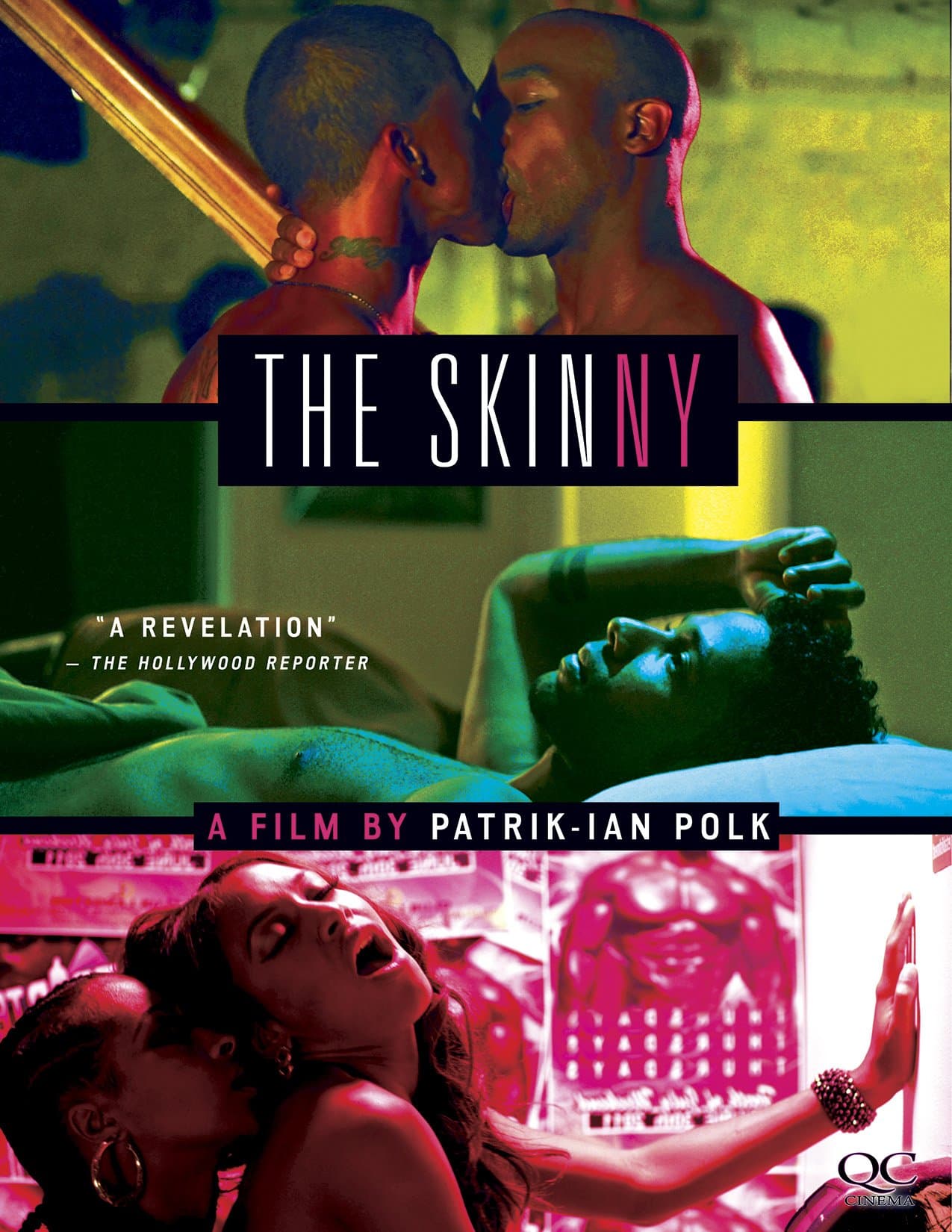 The Skinny