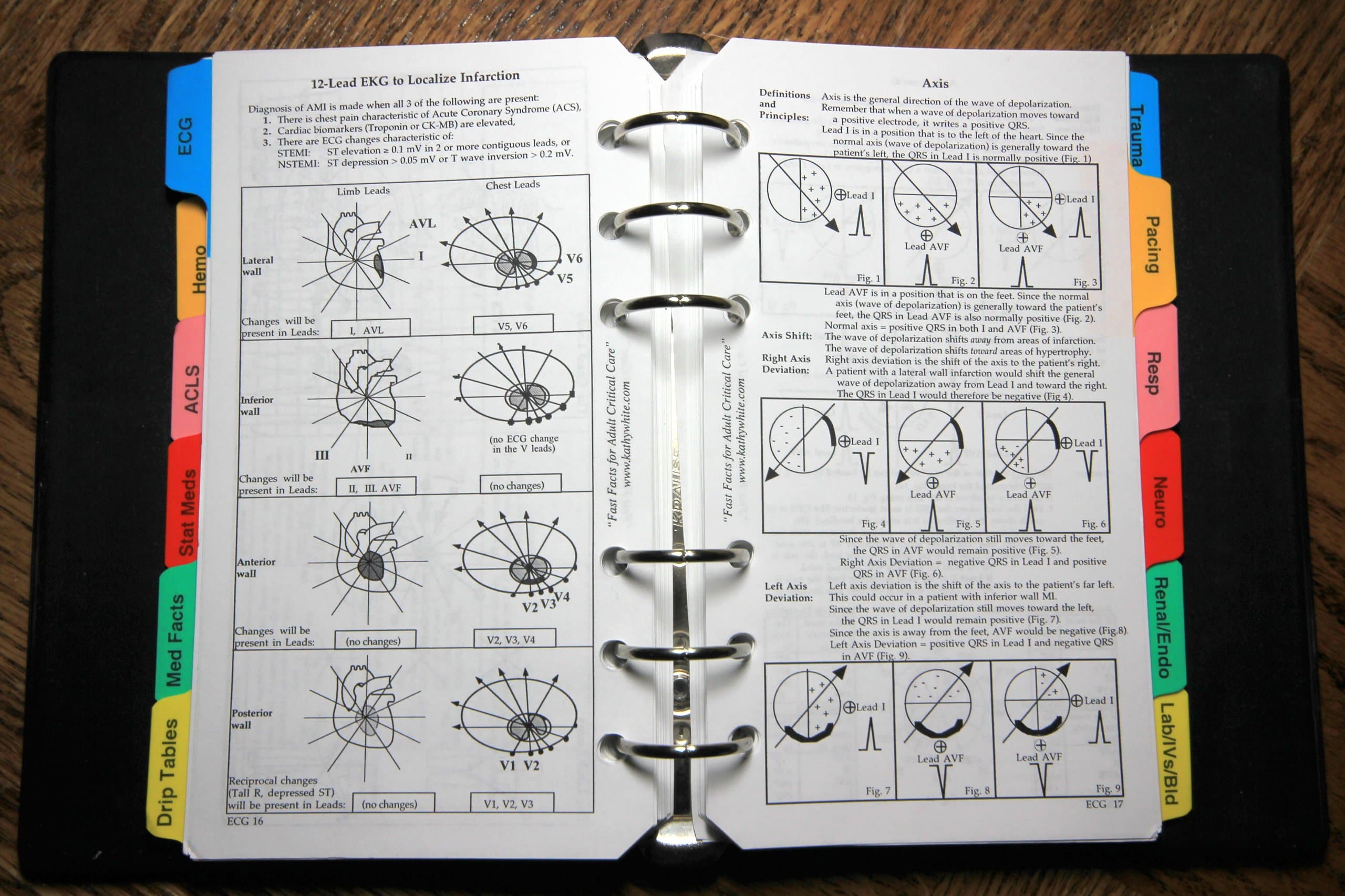 Fast Facts for Adult Critical Care Ring-bound – Import, 30 June 2005
