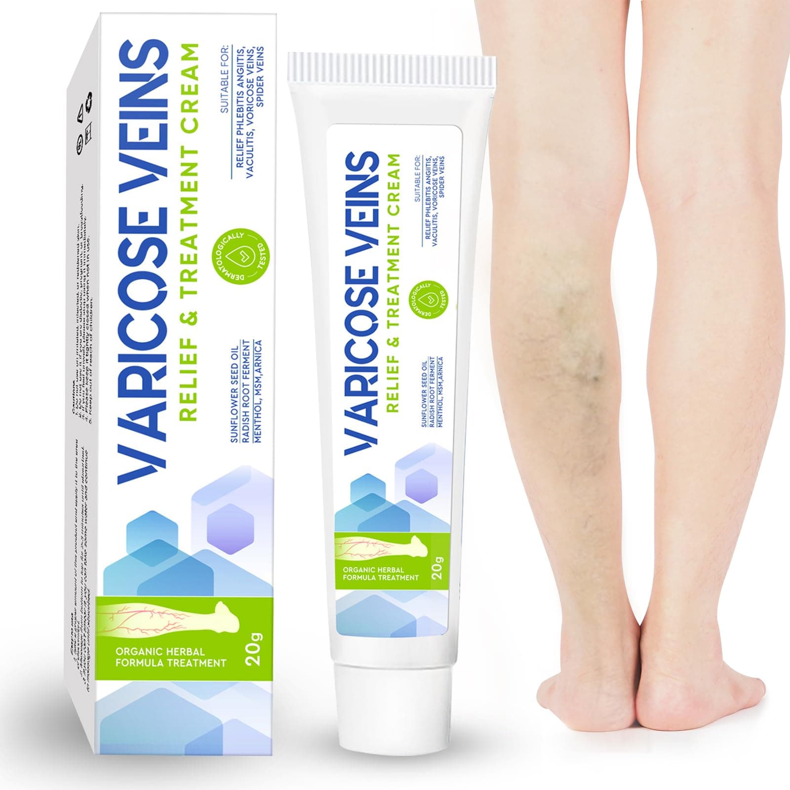 MOSKILA Varicose Veins Treatment for Legs, Nature Varicose Veins Cream, Effective Varicose Veins Treatment for Varicose & Spider Veins, Relieve Leg Swelling & Fatigue Relief, 0.7oz