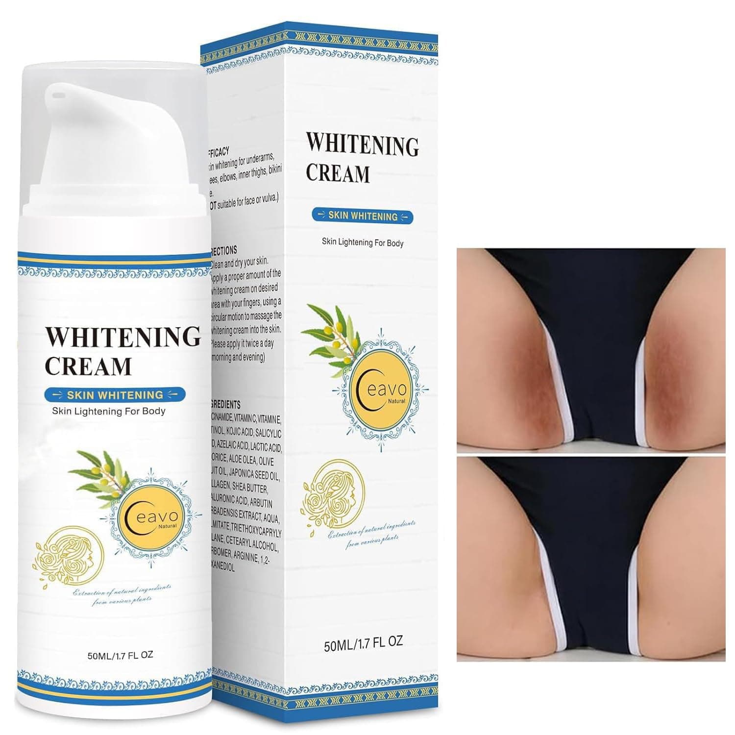 Skin Whitening Cream Bleaching Cream for Body Intimate Area, Private Parts, Underarm, Knees, Elbows, Inner Thigh, Bikini Areas, Bikini Line, Lightening Dark Spot Remover For Intimate Part (1.7FL OZ)